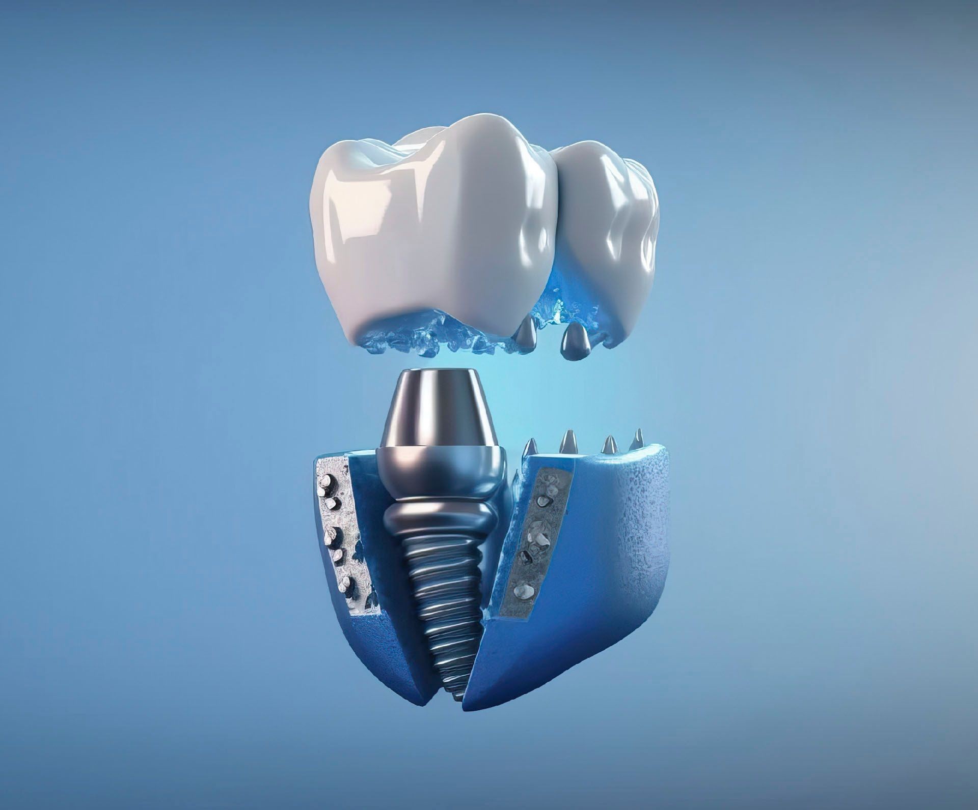 cad cam