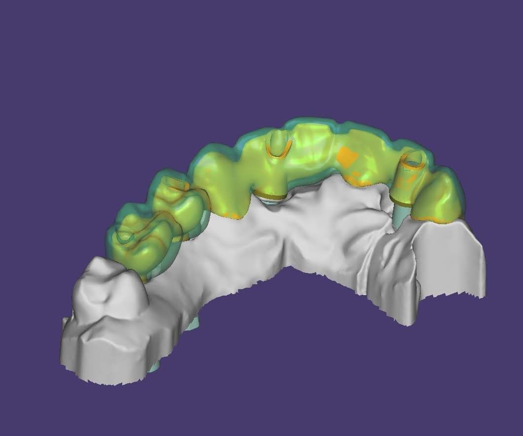 Tu nuevos dientes  por ordenador 